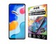 Folie Silicon Upzz Max, Compatibila Cu Xiaomi Redmi Note 11s, Regenerabila, Case Friendly